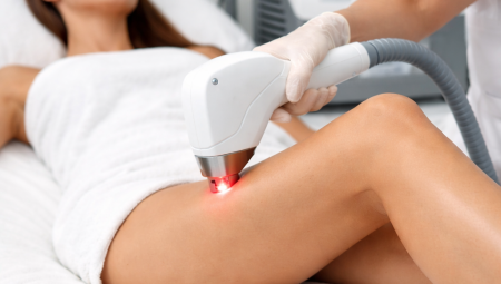 Lazer Epilasyon Nedir? Nasıl Çalışır?